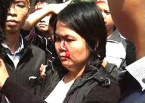 Bất an nơi an cư